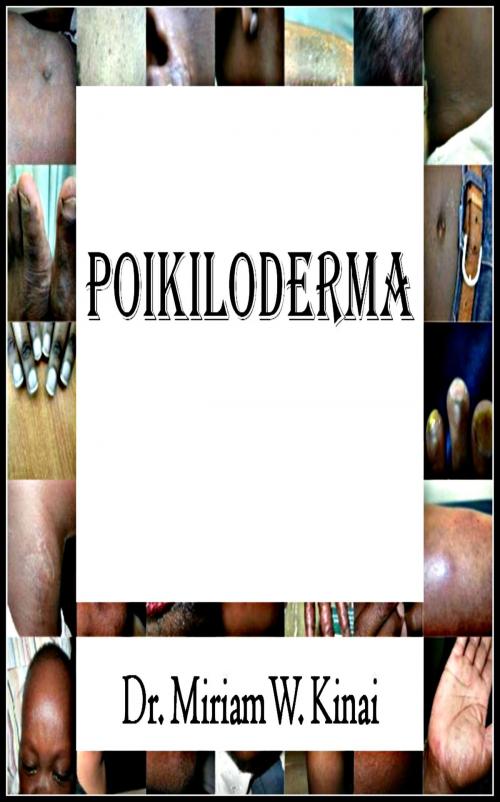 Cover of the book Poikiloderma by Miriam Kinai, Miriam Kinai
