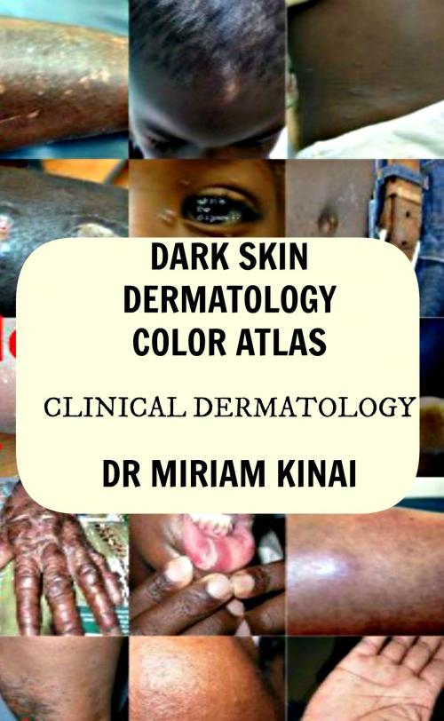 Cover of the book Dark Skin Dermatology Color Atlas by Miriam Kinai, Miriam Kinai