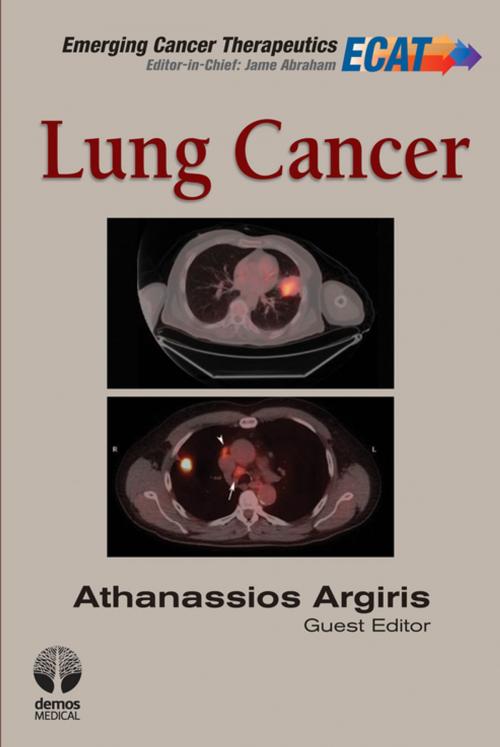 Cover of the book Lung Cancer by , Springer Publishing Company