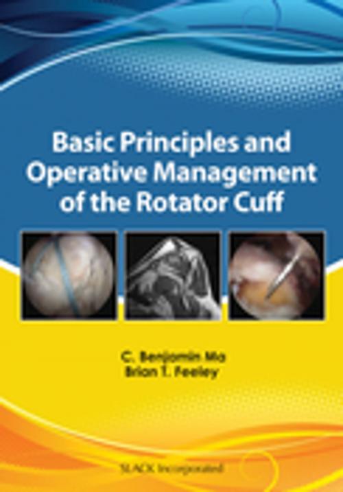 Cover of the book Basic Principles and Operative Management of the Rotator Cuff by , SLACK Incorporated