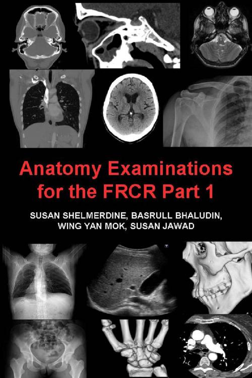 Cover of the book Anatomy Examinations for the FRCR Part 1 by Susan Shelmerdine, Andrews UK