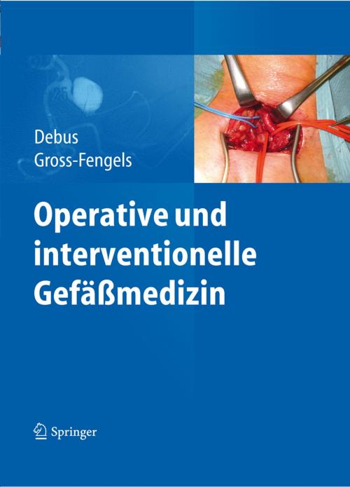 Cover of the book Operative und interventionelle Gefäßmedizin by , Springer Berlin Heidelberg