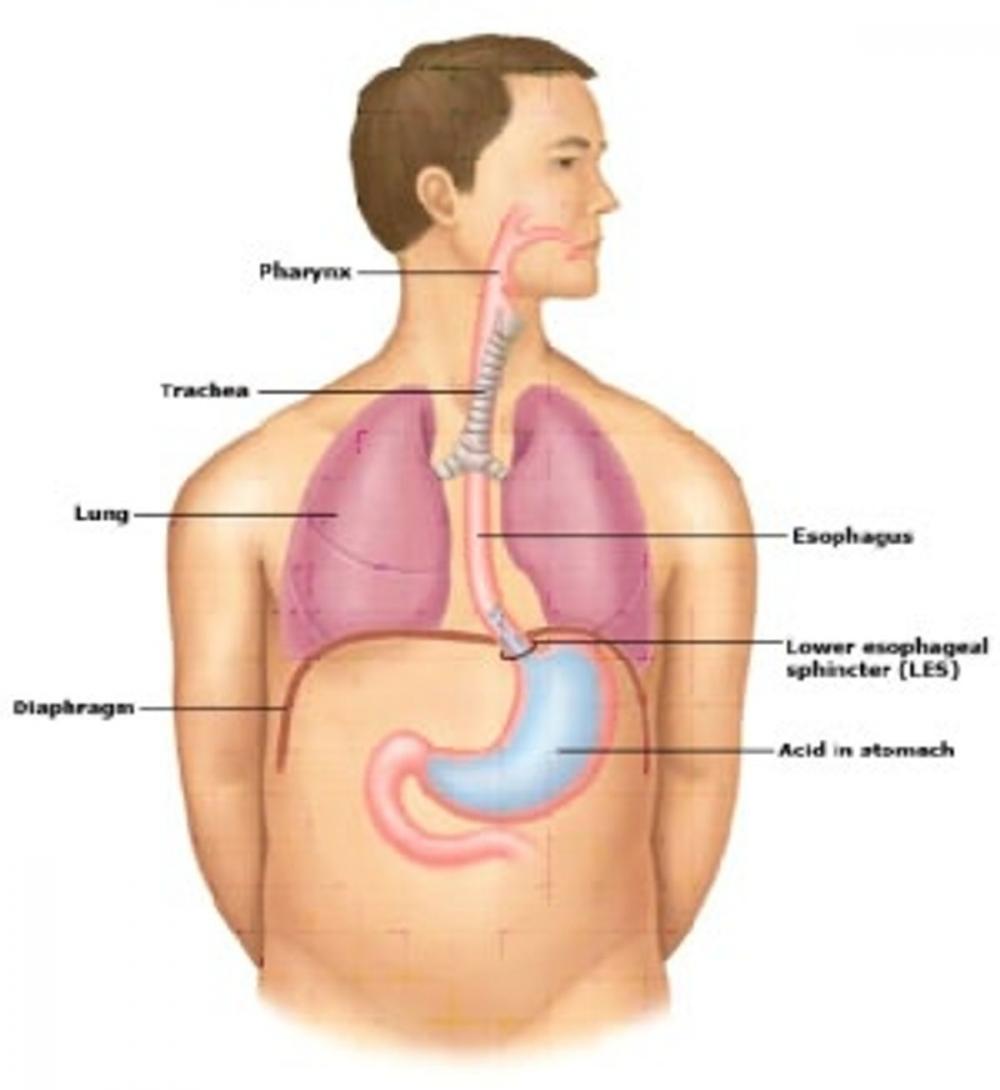 Big bigCover of An Informative Guide About Barrett's Esophagus
