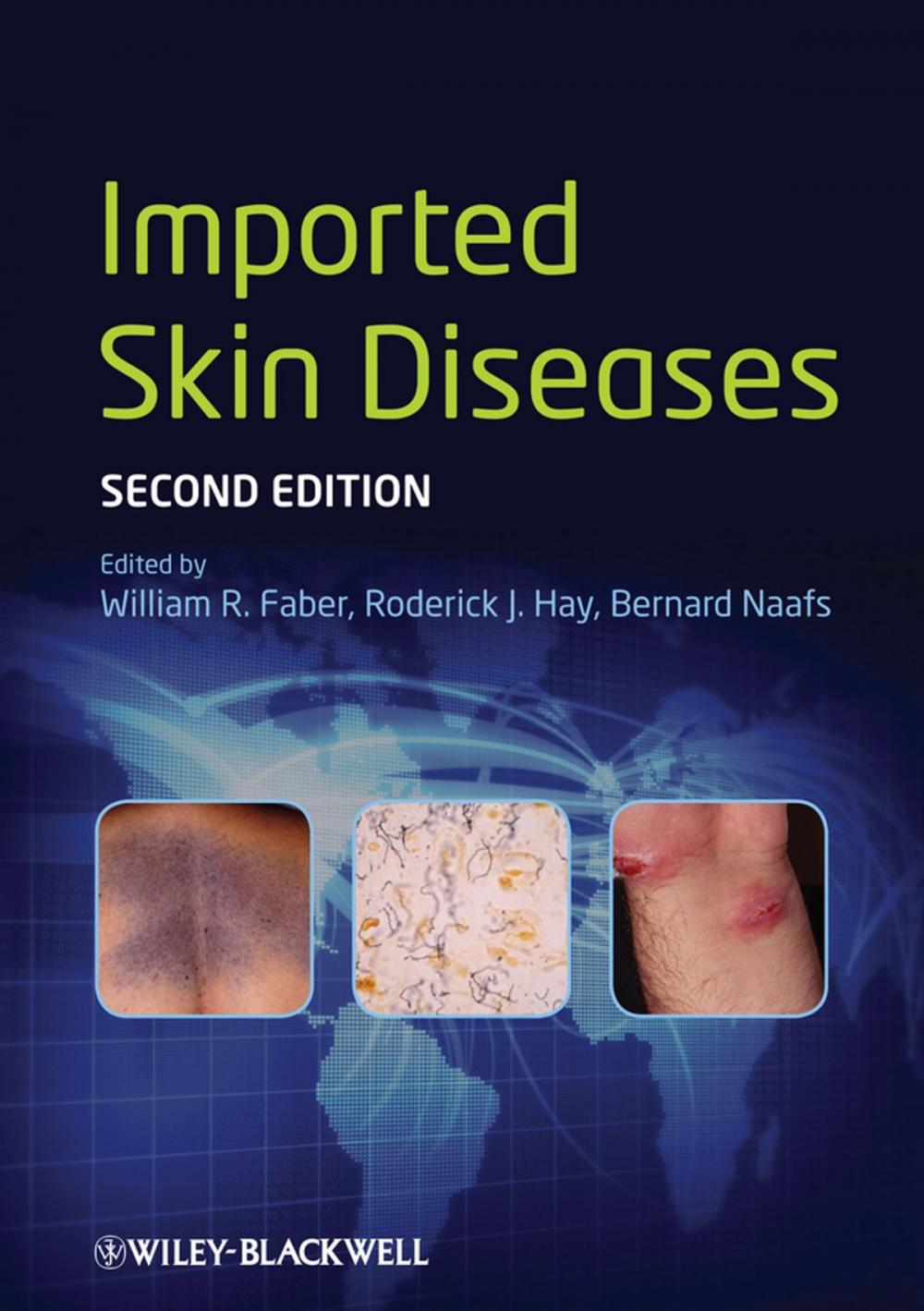 Big bigCover of Imported Skin Diseases