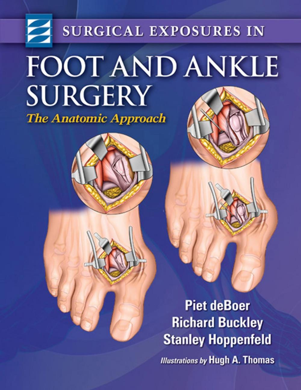 Big bigCover of Surgical Exposures in Foot & Ankle Surgery