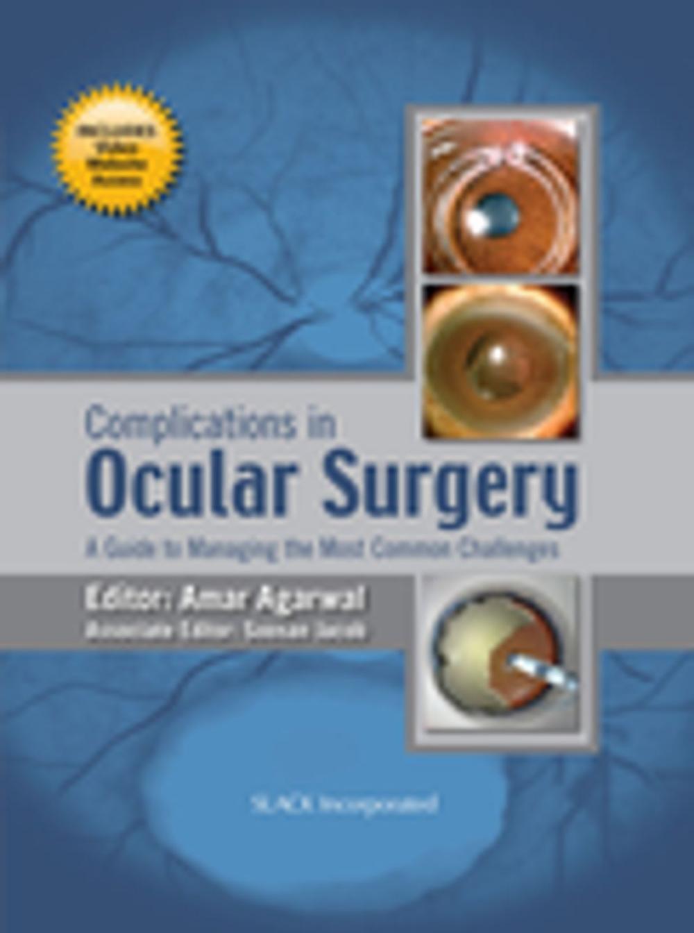 Big bigCover of Complications in Ocular Surgery