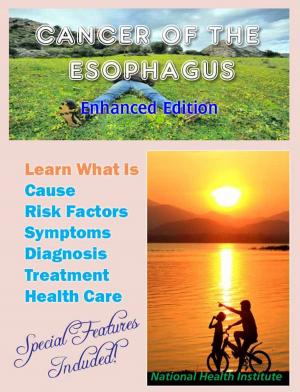 Cover of the book Cancer of the Esophagus by National Health Institute