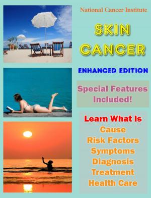 Book cover of Skin Cancer