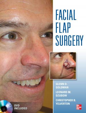 Book cover of Facial Flaps Surgery