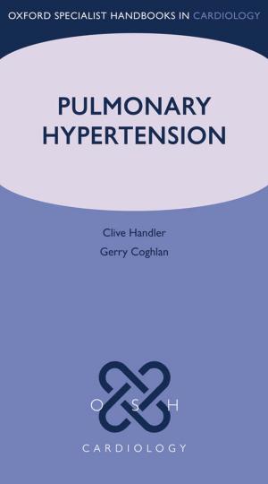 Cover of the book Pulmonary Hypertension by Hazel Fox, QC, Philippa Webb