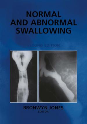 Cover of the book Normal and Abnormal Swallowing by Hao Yu, Ruijing Shen, Sheldon X.-D. Tan