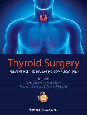 Cover of the book Thyroid Surgery by John Paul Mueller