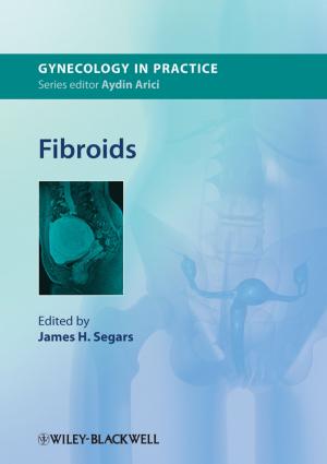 Cover of the book Fibroids by Liz Meerabeau, Kerri Wright