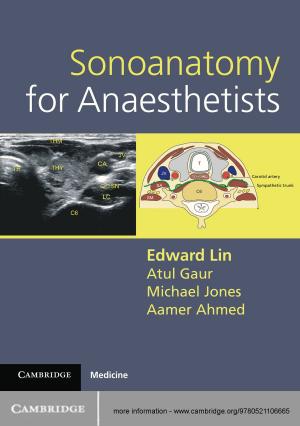 Book cover of Sonoanatomy for Anaesthetists