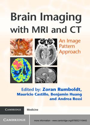 Cover of the book Brain Imaging with MRI and CT by Richard Ned Lebow