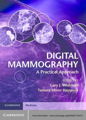 Cover of the book Digital Mammography by Debbie Guatelli-Steinberg