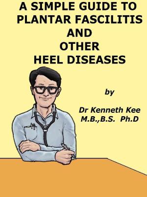 Book cover of A Simple Guide to Plantar Fascilitis and Heel diseases