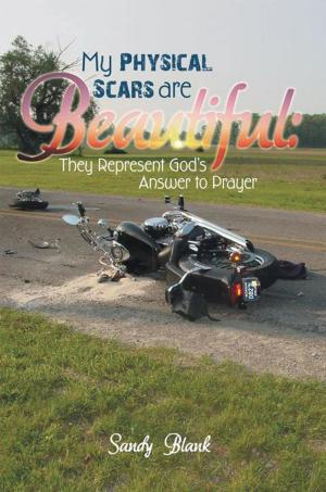 Cover of the book My Physical Scars Are Beautiful: by Jimmie R. Horton