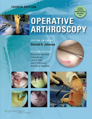 Book cover of Operative Arthroscopy