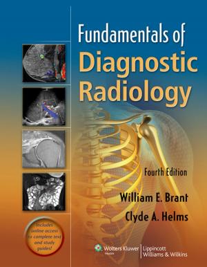 Cover of the book Fundamentals of Diagnostic Radiology by Dennis W. Boulware, Gustavo R. Heudebert