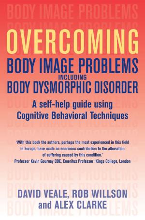 Book cover of Overcoming Body Image Problems including Body Dysmorphic Disorder
