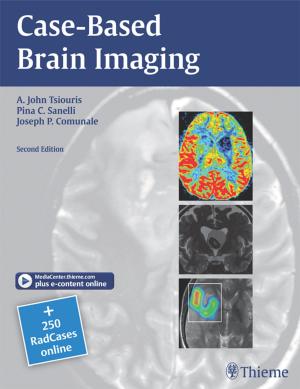 Cover of the book Case-Based Brain Imaging by Meir Marmor
