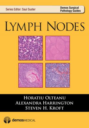 Book cover of Lymph Nodes