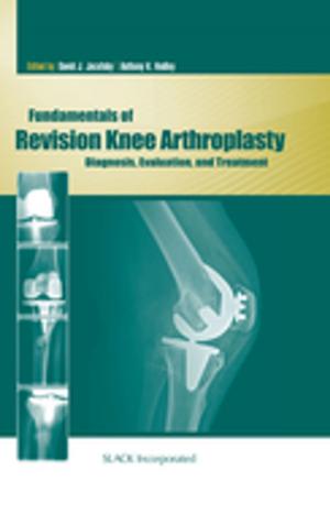 Cover of the book Fundamentals of Revision Knee Arthroplasty by 