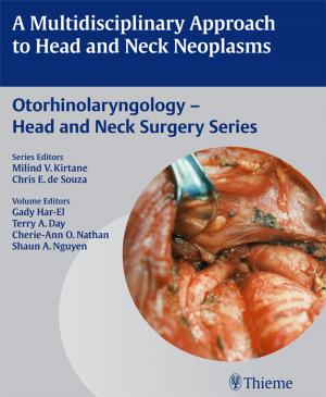 Cover of the book Multidisciplinary Approach to Head and Neck Neoplasms by Alex F. Johnson, Barbara H. Jacobson