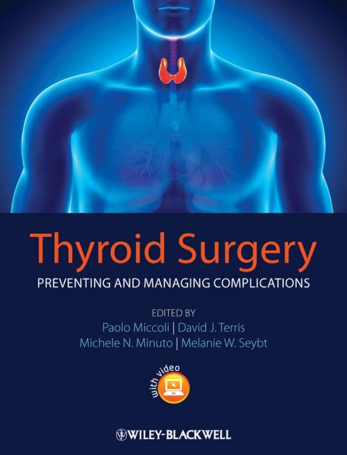 Cover of the book Thyroid Surgery by , Wiley