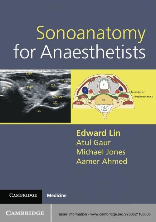 Cover of the book Sonoanatomy for Anaesthetists by Edward Lin, Atul Gaur, Michael Jones, Aamer Ahmed, Cambridge University Press