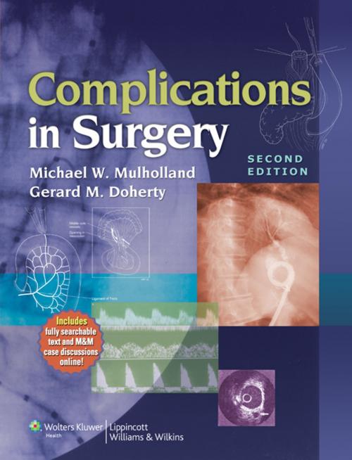 Cover of the book Complications in Surgery by Michael W. Mulholland, Gerard M. Doherty, Wolters Kluwer Health