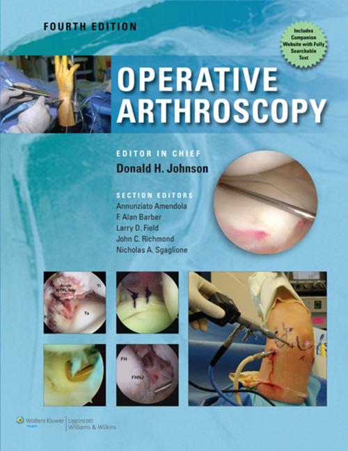 Cover of the book Operative Arthroscopy by Don Johnson, Ned Annuziato Amendola, F. Alan Barber, Larry D. Field, John C. Richmond, Nicholas Sgaglione, Wolters Kluwer Health
