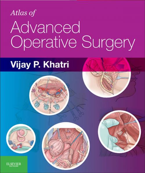 Cover of the book Atlas of Advanced Operative Surgery E-Book by Vijay P. Khatri, MBChB, MBA, FACS, Elsevier Health Sciences