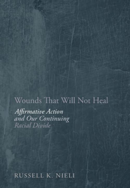 Cover of the book Wounds That Will Not Heal by Russell K Nieli, Encounter Books