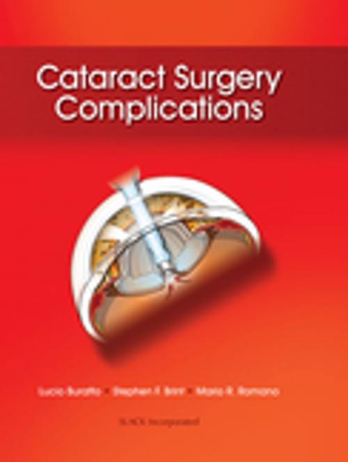 Cover of the book Cataract Surgery Complications by , SLACK Incorporated