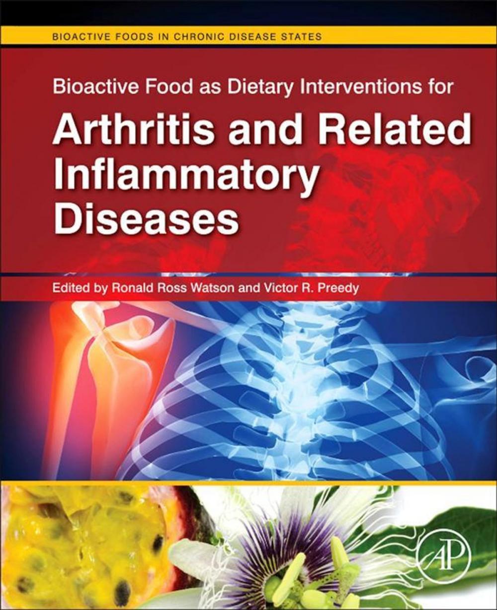 Big bigCover of Bioactive Food as Dietary Interventions for Arthritis and Related Inflammatory Diseases