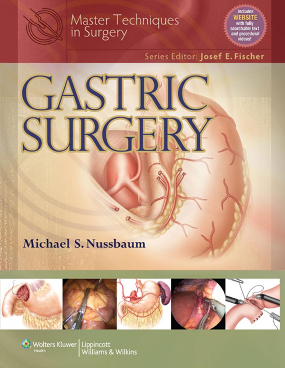 Big bigCover of Master Techniques in Surgery: Gastric Surgery