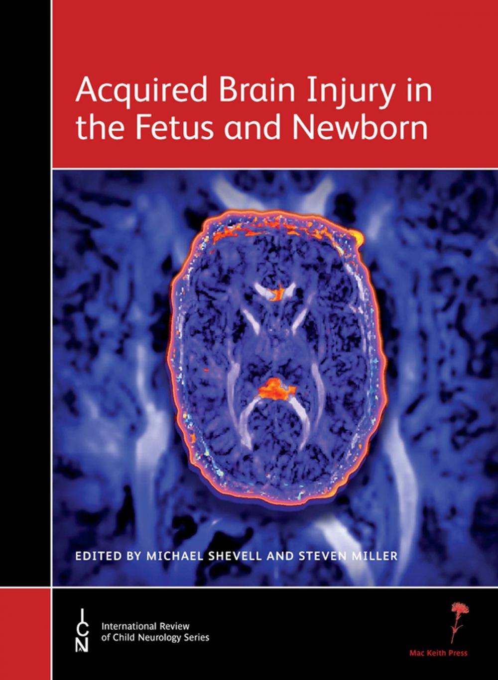 Big bigCover of Acquired Brain Injury in the Fetus and Newborn