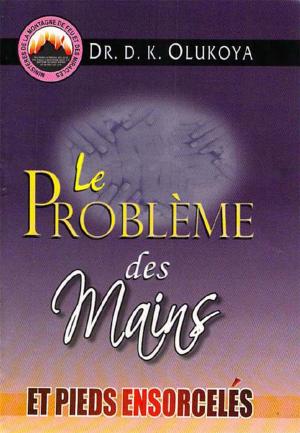 Book cover of Le Probleme des Mains et Pieds Ensorceles