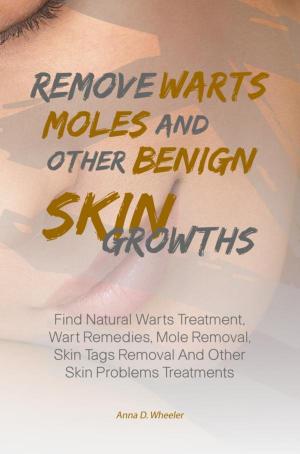 Cover of the book Remove Warts, Moles And Other Benign Skin Growths by Debbie T. Patterson