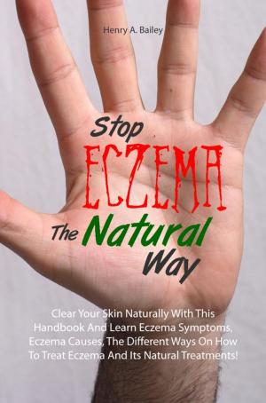 Cover of the book Stop Eczema The Natural Way by Fredrick K. Urban