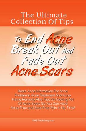 Cover of the book The Ultimate Collection Of Tips To End Acne Break Out And Fade Out Acne Scars by James M. Rocha