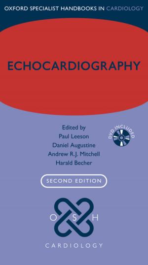 Book cover of Echocardiography