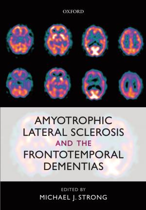 Cover of the book Amyotrophic Lateral Sclerosis and the Frontotemporal Dementias by Robert H. Swendsen