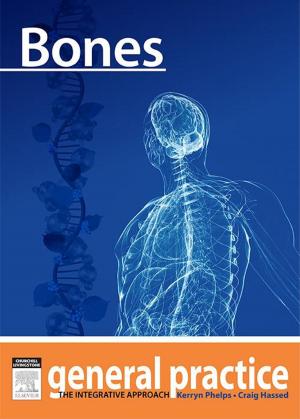 Cover of the book Bones by Yifrah Kaminer, MD, MBA