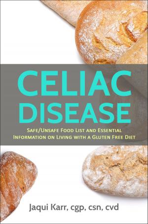 Cover of Celiac Disease; Safe/Unsafe Food List and Essential Information on Living with a Gluten Free Diet