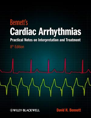 Cover of the book Bennett's Cardiac Arrhythmias by Pascale Zaraté