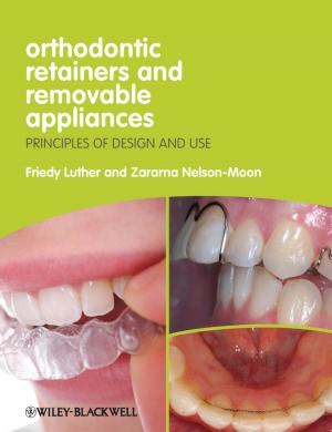 Cover of the book Orthodontic Retainers and Removable Appliances by Anthony Reid