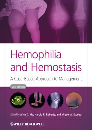 Cover of the book Hemophilia and Hemostasis by Jane Straus, Lester Kaufman, Tom Stern